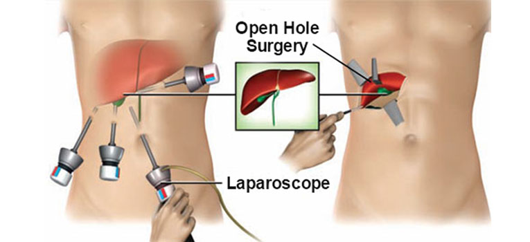 Open and Laparoscopic Surgery